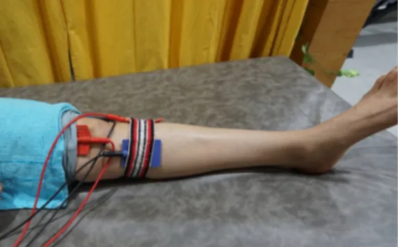 Electrotherapy Treatment